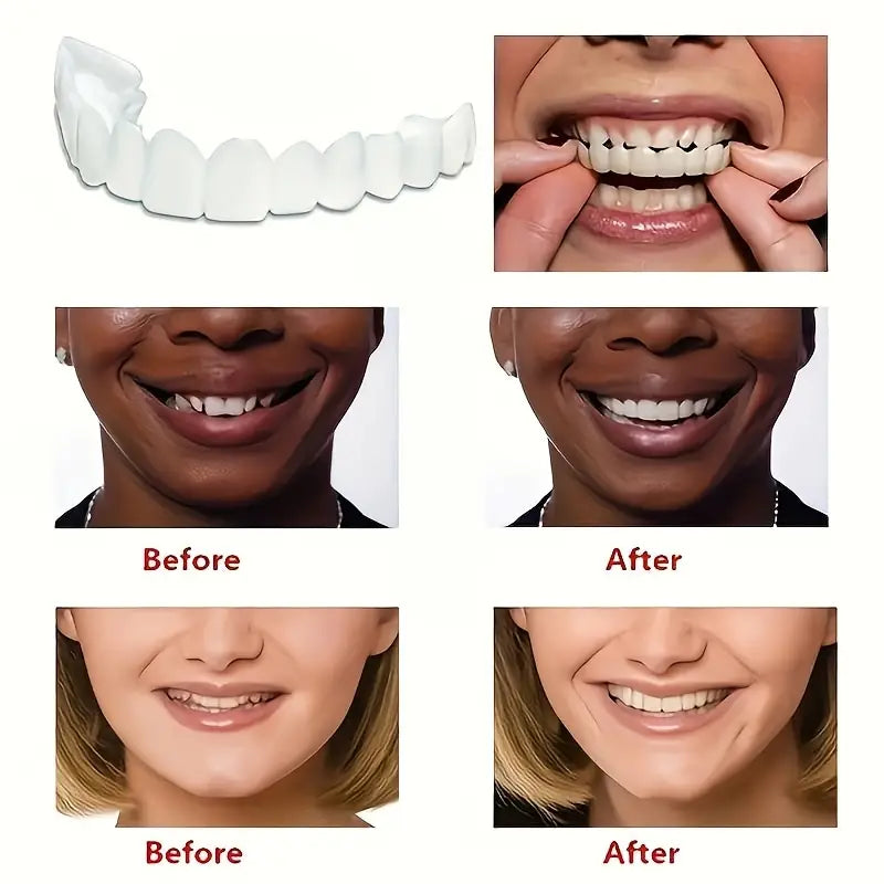 Snap On Smile Braces Teeth Kit For Men & Women